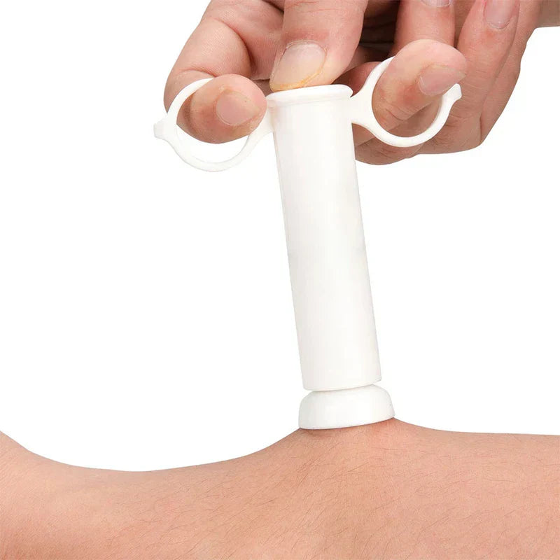 saugpumpe zur giftentfernung - Hand hält das Saugpumpenwerkzeug und demonstriert die Anwendung auf der Haut eines Arms