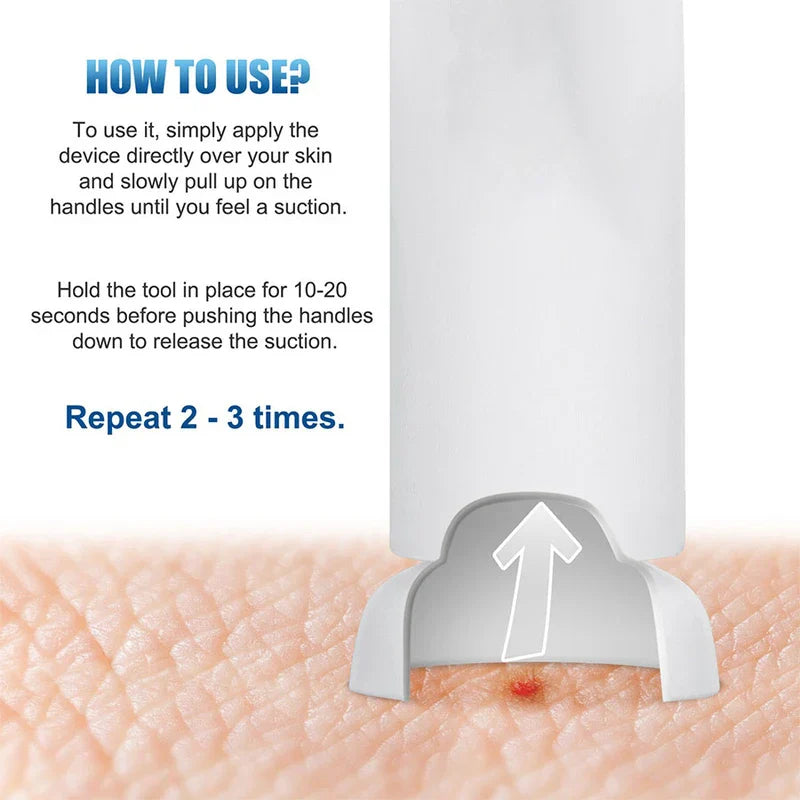 Venom Extractor Suction Pump Kit Emergency