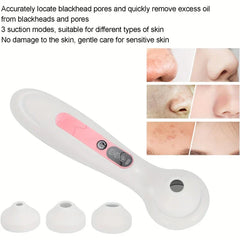 Blackhead remover vacuum with three suction heads, plus before-after skin comparison photos on the right