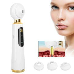 Blackhead Remover Vacuum - Handheld device with suction tips, suction level indicators, and cross-section diagram of blackhead extraction