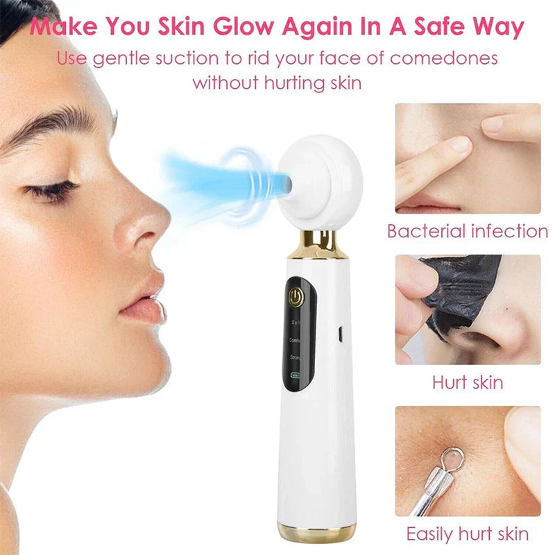 extractor de puntos negros con vacío - Dispositivo de succión de puntos negros siendo usado en el rostro de una persona, con tres imágenes más pequeñas que demuestran métodos deficientes de limpieza facial