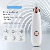 White Blackhead Remover Vacuum Battery Operated