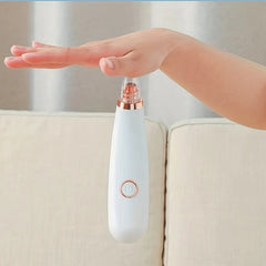 White Blackhead Remover Vacuum Battery Operated