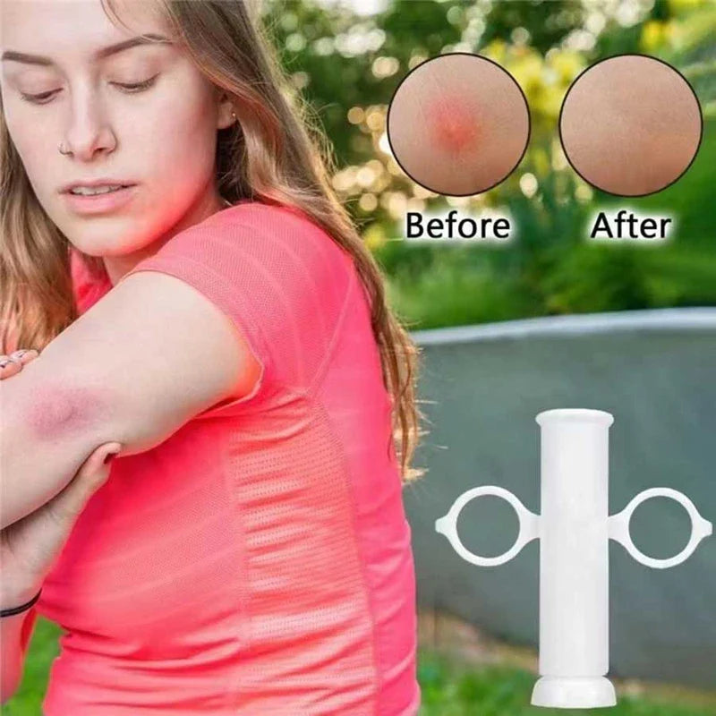 Venom Extractor Suction Pump Kit - Woman looking at an inflamed arm bite, with before/after skin close-ups and a white plastic suction tool shown.