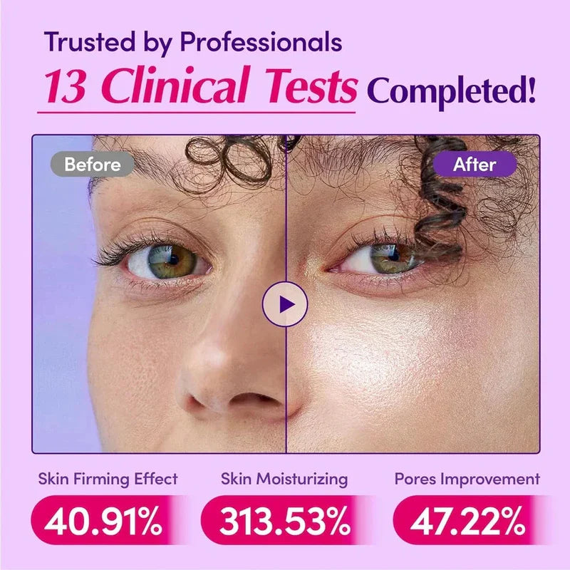 Before and after facial comparison for plumping serum, with 13 clinical tests and improvement percentage labels