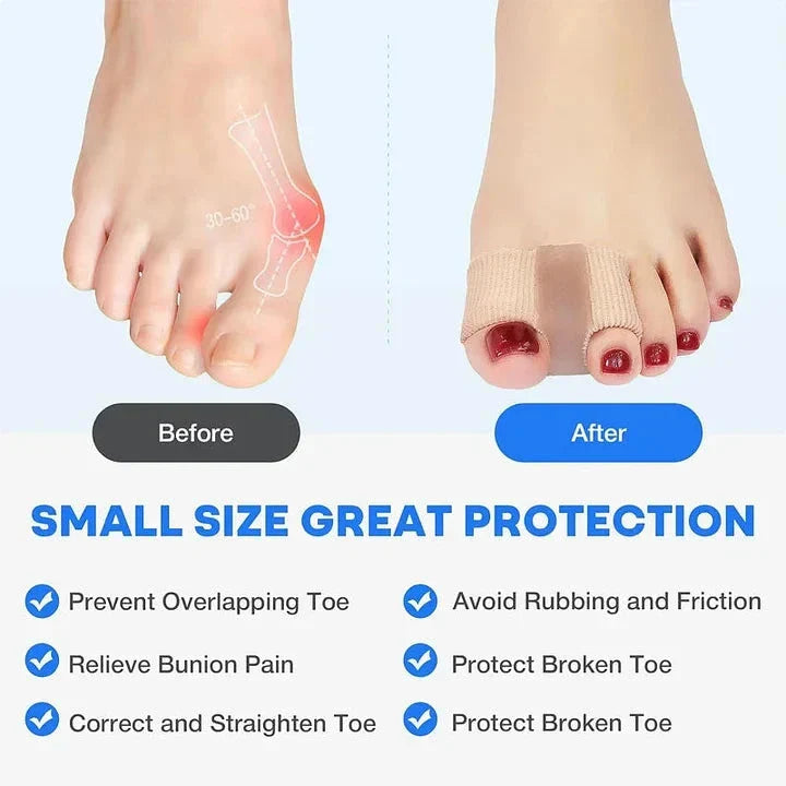 Left side shows a foot with bunion diagram labeled 'Before', right side shows foot wearing toe separator labeled 'After', below is text 'SMALL SIZE GREAT PROTECTION' and six checkmarked feature lines.
