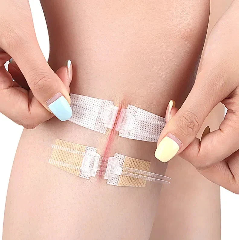 Emergency wound closures device package with two sterile strips