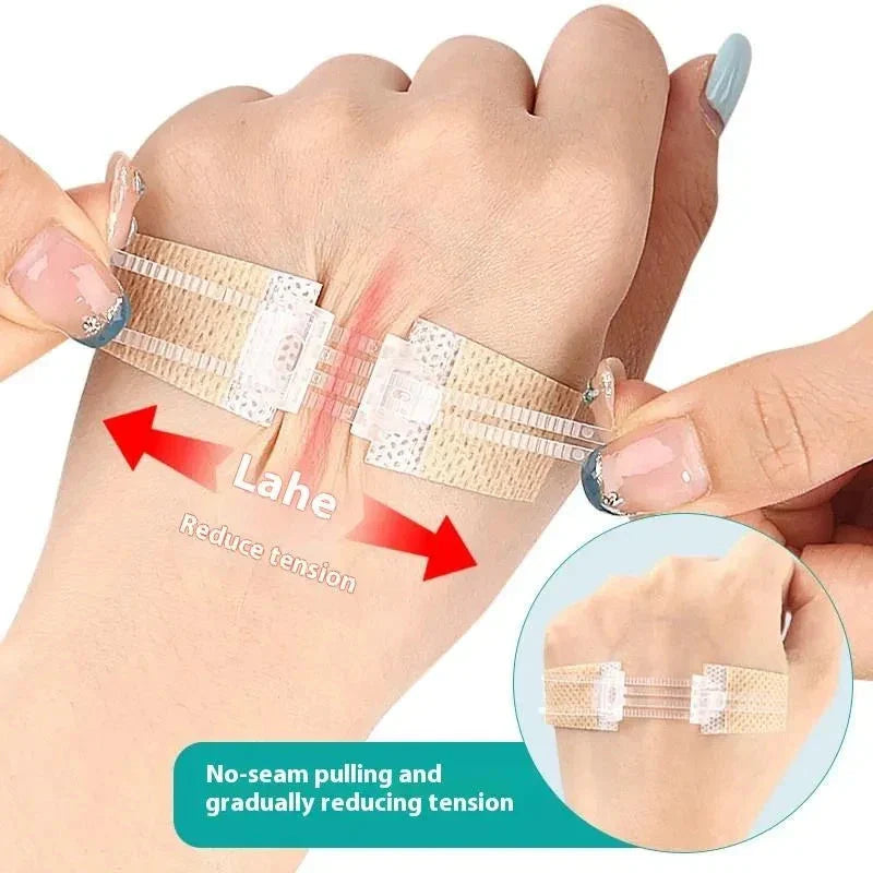 Emergency wound closures device applied on skin