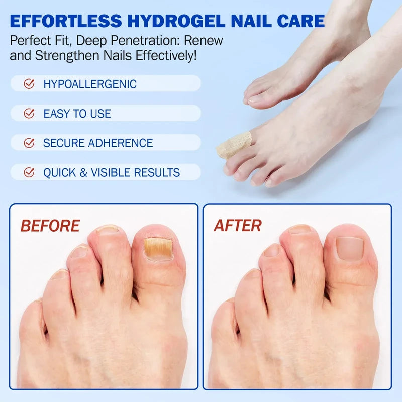 Fungus Patch - Before and after comparison of a damaged toenail becoming healthy, four feature checklists, foot with a toe wrap