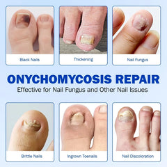 Fungus Patch - Grid of six problematic nail examples: black nail, thickening, fungus, brittle nail, ingrown nail, discolored nail with repair heading