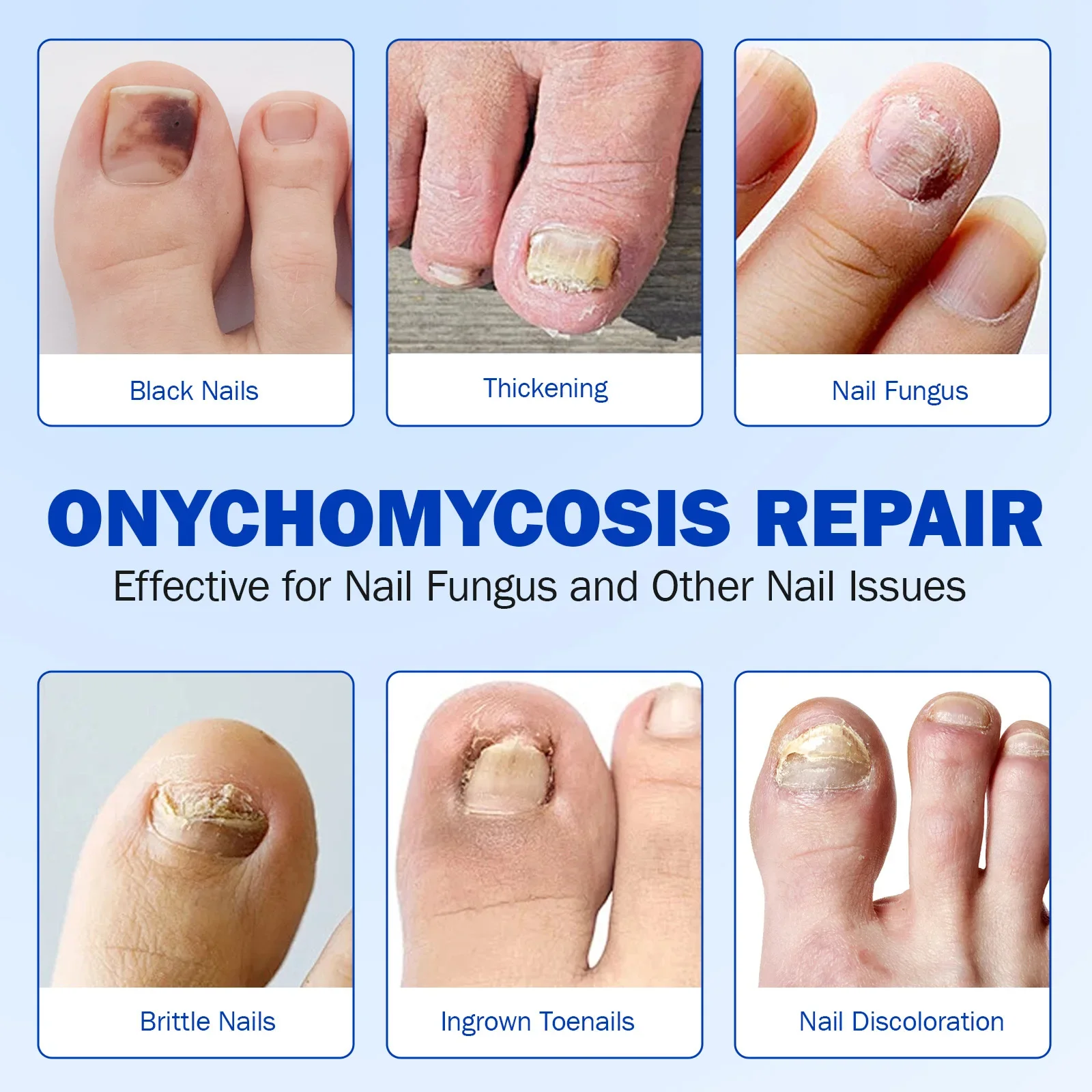 Toenail Fungus Patch
