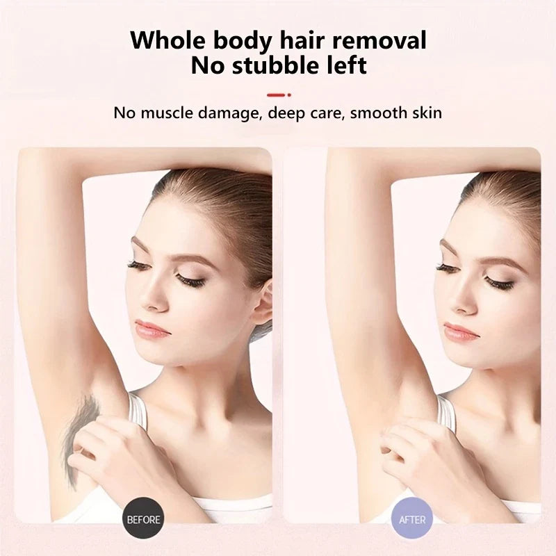 5-in-1 Electric Epilator Shaver Callus Remover Kit