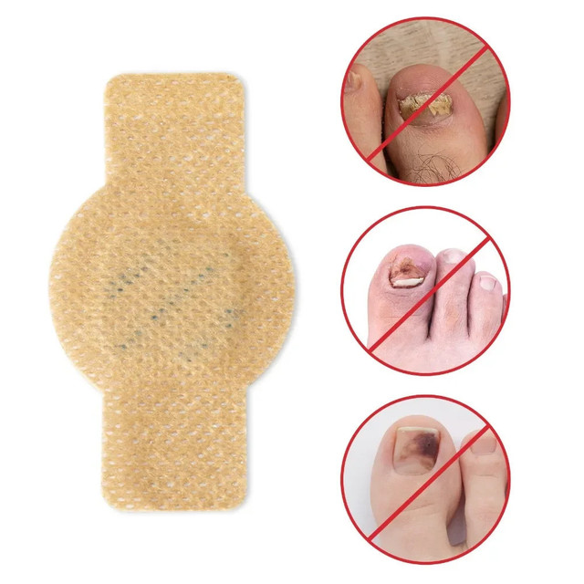 Toenail Fungus Patch