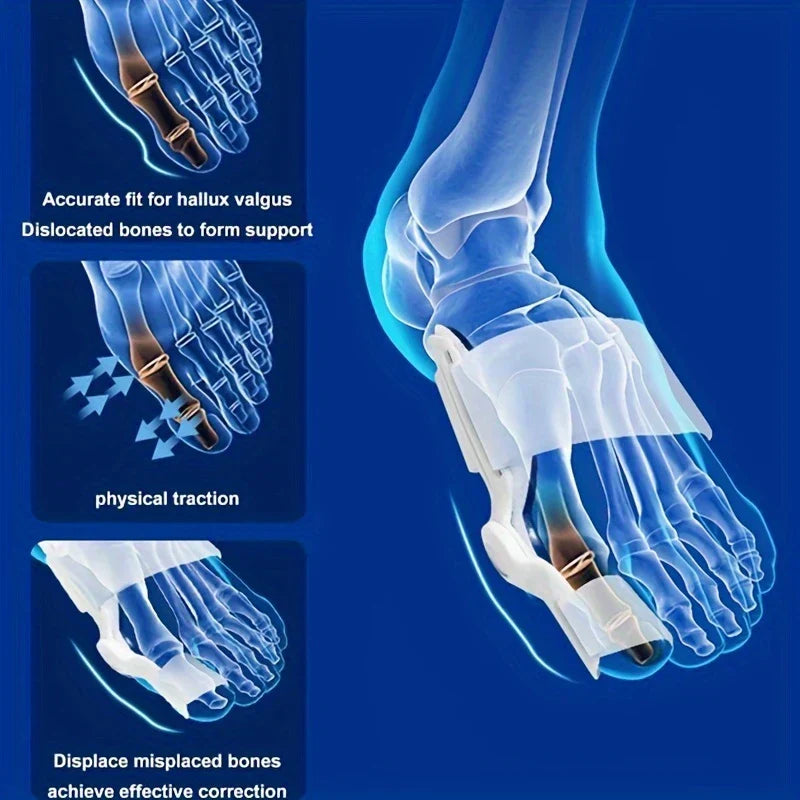Adjustable Bunion Corrector Toe Separator Relief