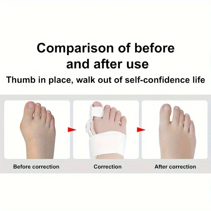 Adjustable Bunion Corrector Toe Separator Relief