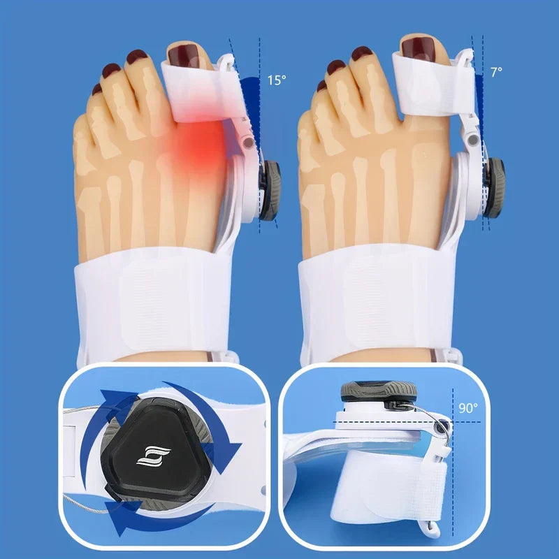 Adjustable Bunion Corrector Toe Straightener Splint
