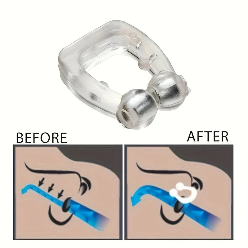 Anti Snoring Nose Vents Nasal Dilators Set