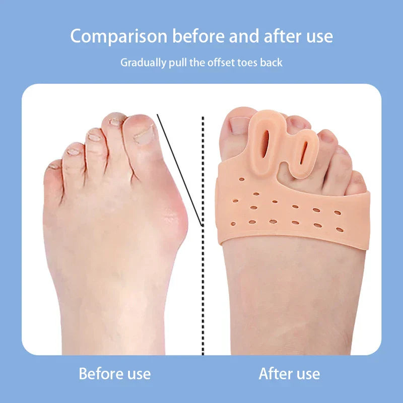 Arch Support Bunion Corrector Sleeve