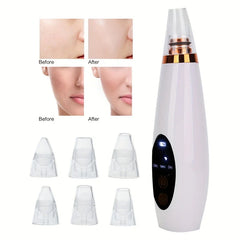 Blackhead Remover Vacuum Pore Cleaner (6 Probes)