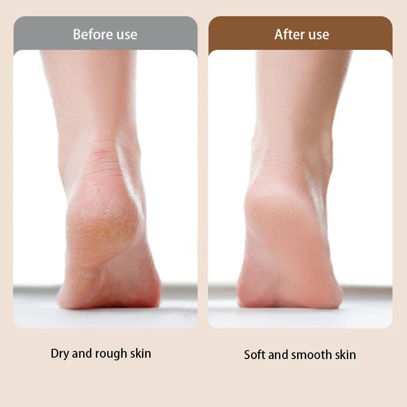 Cordless Portable Electric Foot File Callus Remover