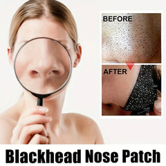 Deep Cleansing Pore Blackhead Remover Nose Strips (10)