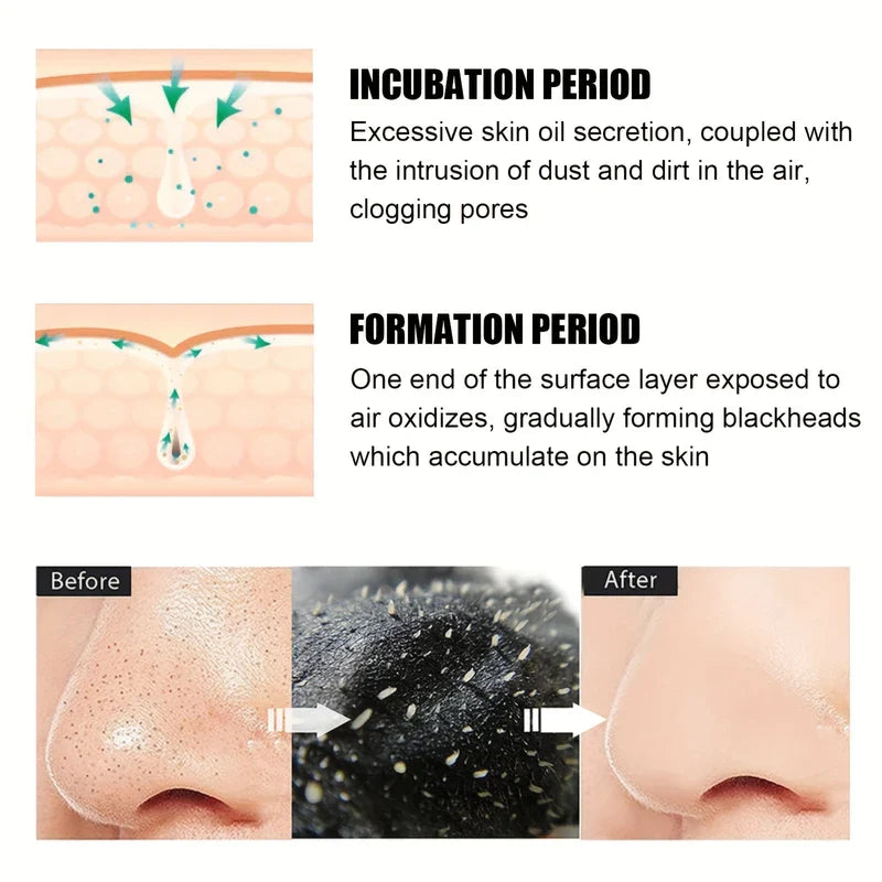 Deep Cleansing Pore Blackhead Remover Nose Strips (10)