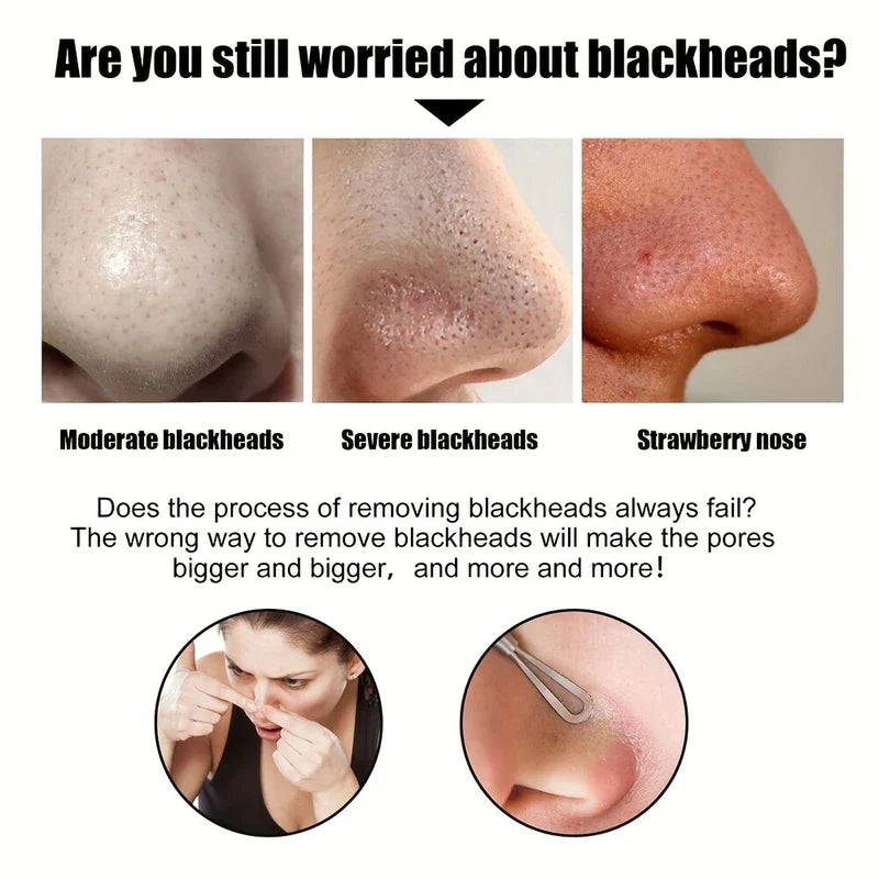 Deep Cleansing Pore Blackhead Remover Nose Strips (10)