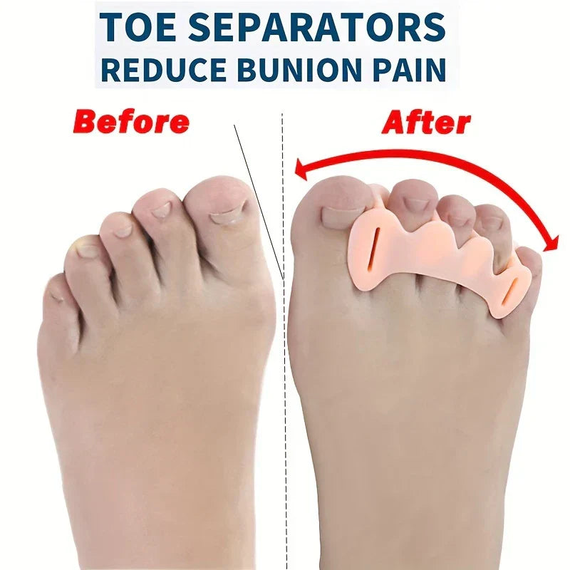 Gel Bunion Corrector Toe Separator Straightener