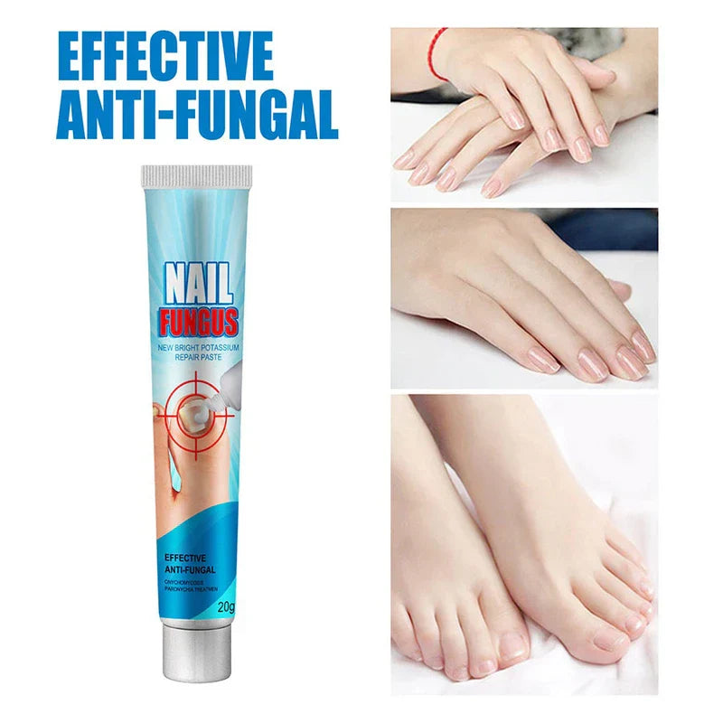 Nail Fungus Treatment Ointment Cream