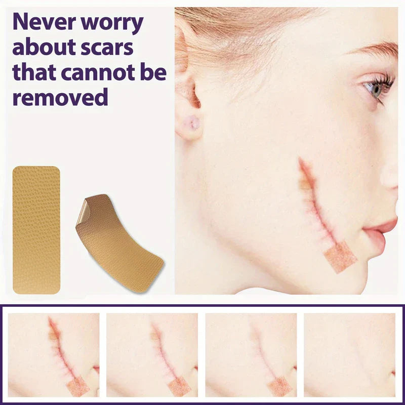 Silicone Scar Removal Sheets Tape Strips