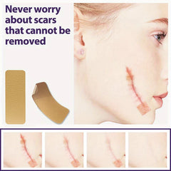 Silicone Scar Removal Sheets Tape Strips