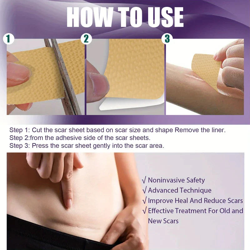 Silicone Scar Removal Sheets Tape Strips