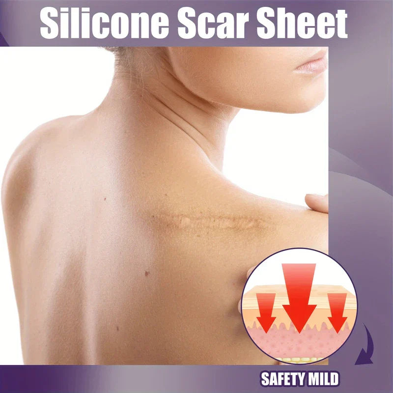 Silicone Scar Removal Sheets Tape Strips