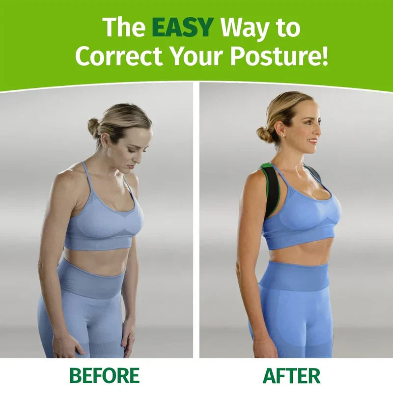 X-Shape Posture Corrector Back Brace