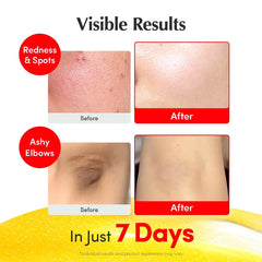 Vitamin C Illuminating Serum 30mL