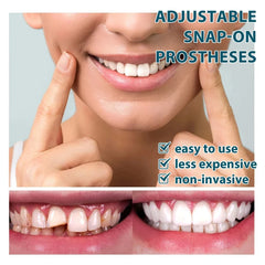 Adjustable Snap-On Dentures